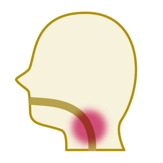 のどの性病のイメージ