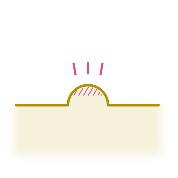 できもののイメージ