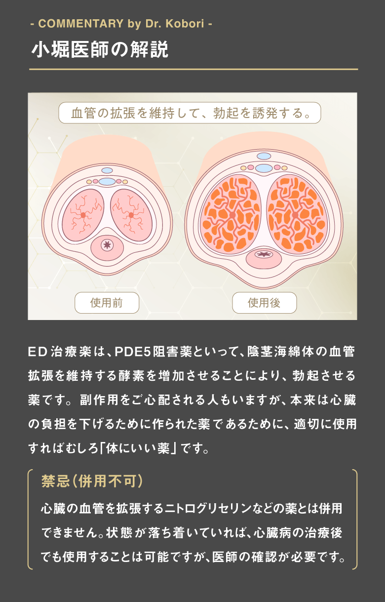 ED治療薬は、PDE5薬といって、陰茎海綿体の血管拡張を維持する酵素を増加させることにより、勃起させる薬です。